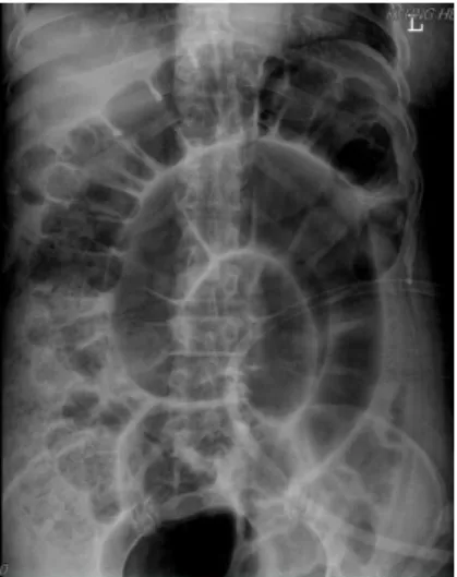 Fig. 2. Abdominal X-ray of patient (2015.10.24).