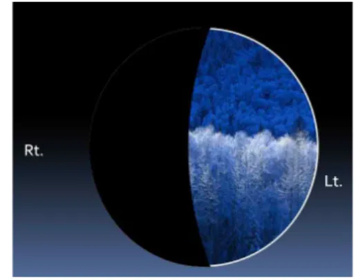 Fig. 3. Result of confrontation visual field exam (2013-06-12).