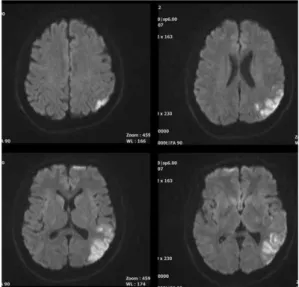 Fig. 4. Brain MRI.
