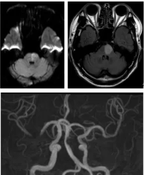 Fig. 1. Brain MRI &amp; MRA (2015-04-16).