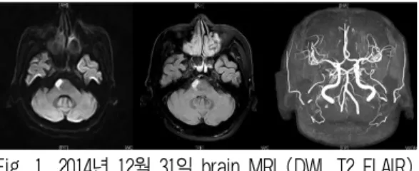 Fig. 1. 2014년 12월 31일 brain MRI (DWI, T2 FLAIR), MRA. 2) CVA check(2015년 1월 6일) (1) Mental : alert~drowsy (2) Pupil reflex : 0=0(2→1,2→1) (3) Neck stiffness :  -(4) Headache/dizziness : -/+