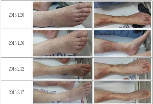 Fig. 2. Picture of the patient (edema &amp; redness).