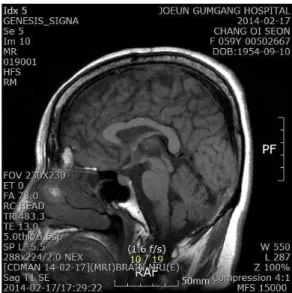 Fig. 1. Brain MRI of a patient.