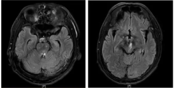 Fig. 1. Magnetic resonance imaging.