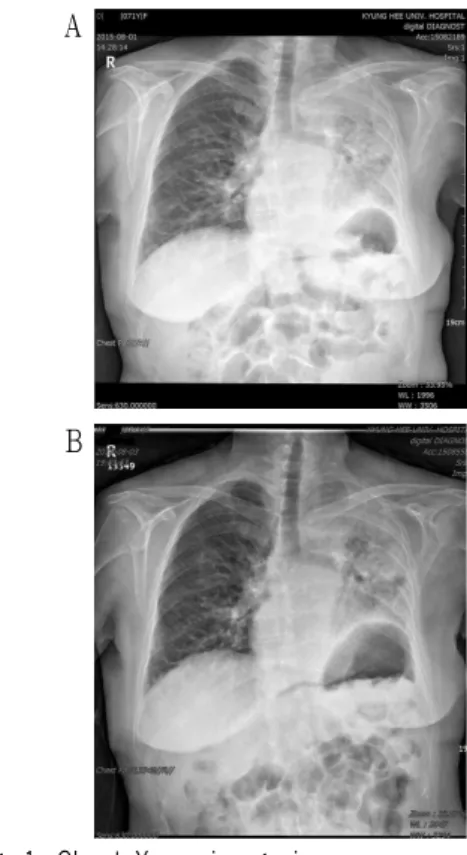 Fig. 1. Chest X-ray image in case.