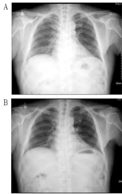 Fig. 4. Chest X-ray image in case.