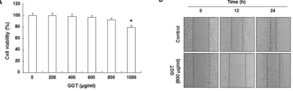 Fig. 1. Effects of GGT on cell viability and motility in human bladder cancer 5637 cells.