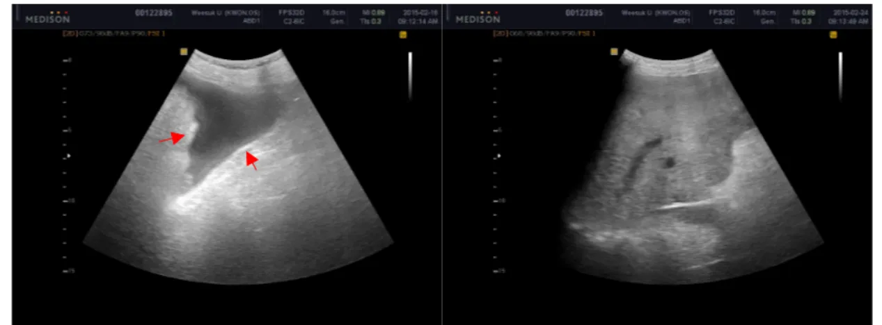 Fig. 2. Changes of Images from ultrasonography.