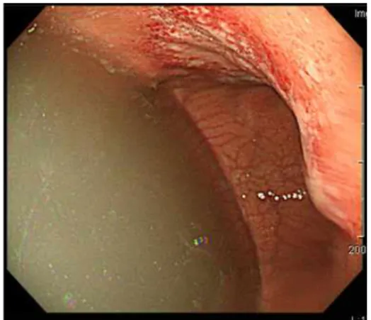 Fig. 3. The massive juice was seen in the stomach (case 3).