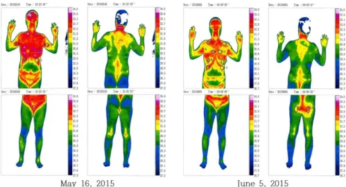 Fig. 1. Digital infrared thermal imaging (DITI) was measured at May 16. 2015 and June 5