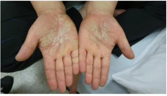 Fig. 6. 2014.12.29. Fig. 7. 2015.01.06. Ⅲ. 고찰 및 결론 인간의 피부는 주변의 환경과 가장 먼저 접하는  부위로 외부환경에 대한 보호장벽의 역할을 하면 서 모든 외부적 스트레스의 수용체로서의 역할도  하게 된다
