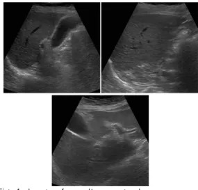 Fig. 1. Images from ultrasonography.
