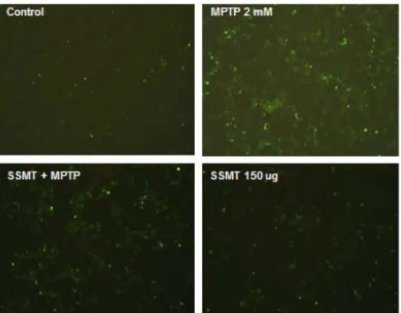 Fig. 7. SSMT reduces release of intracellular calcium  with MPTP treatment in Human neuroblastoma  SH-SY5Y cells.