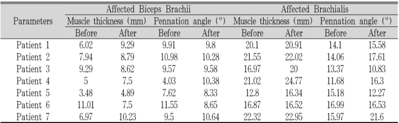 Table  7.  Statistical  Changes  in  Muscle  Thickness  and  Pennation  Angle  of  Affected  Biceps  Brachii  and  Brachialis Before and After Acupuncture
