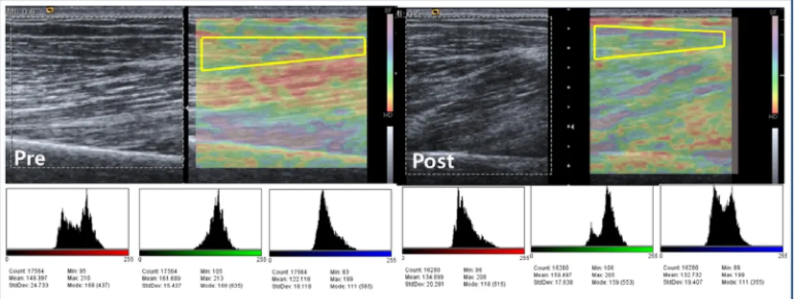 Fig. 1. Color sonoelastography of biceps brachii before and after acupuncture.