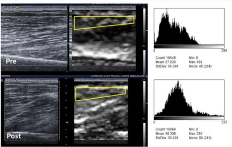 Fig. 3. Hue sonoelastography of biceps brachii before and after acupuncture.