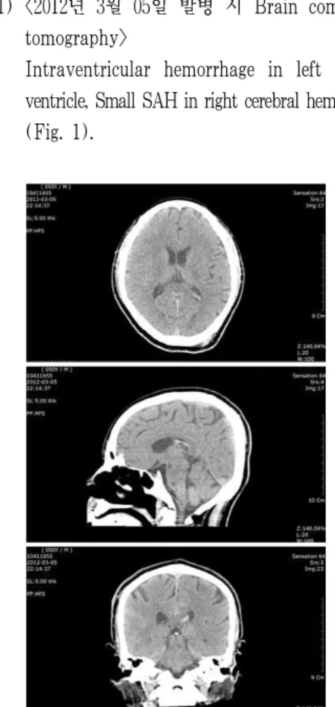 Fig. 1. Brain computed tomography, 2012-03-05.