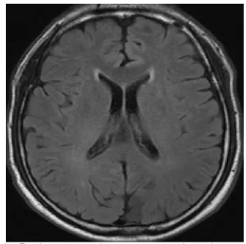 Fig. 1. Brain magnetic resonance imaging.