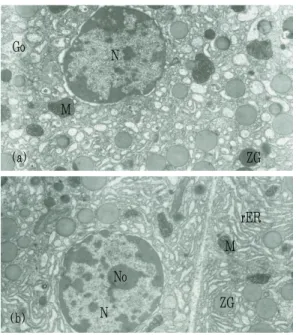 Fig. 10. Light micrographs of pancreatitis in 24  hrs groups.