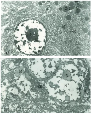Fig. 6. Electron microgrphs of acinar cells from  normal(a) and control groups(b).