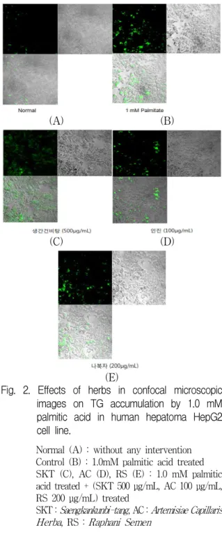 Fig. 2. Effects of herbs in confocal microscopic (E) images on TG accumulation by 1.0 mM palmitic acid in human hepatoma HepG2 cell line.