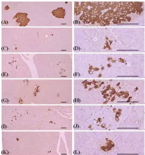 Fig. 9. Histopathological profiles of insulin-immunoreactive cells in the pancreas of intact control (A,B), STZ control (C,D), silymarin 100 (E,F), GOS 800 (G,H), 400 (I,J) and 200 (K,L) mg/kg treated rats.