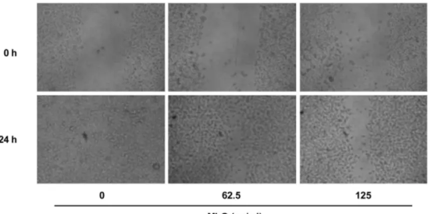 Fig. 5. Effect of MLO on the B16F10 cell migration.
