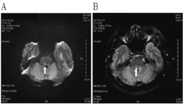 Fig. 1. Brain MR image in case 1.