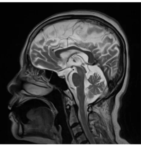 Fig. 1. Brain magnetic resonance images.