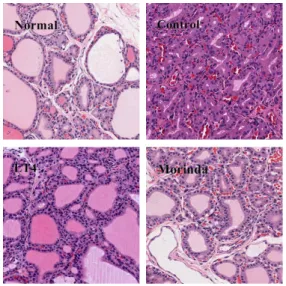 Fig. 2. Histology of thyroid gland of Normal, Control, LT4, Morinda-treated Hypothyroidism rats inducued by PTU.