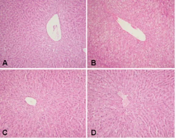 Fig. 1. Representative microscopic findings of the  liver of mouse fed normal diet (A), high-  fat diet alone (B), high-fat diet containing  300 mg/kg.b.w HCA (C) or 3% YCT (D)