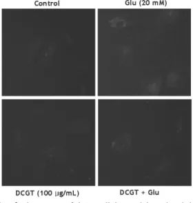 Fig. 9. Bcl2 protein expression by glutamate and/or  DCGT in C6 glial cells.