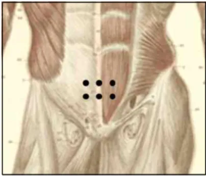 Fig. 2. Acupuncture points on abdomen 2) 봉약침치료