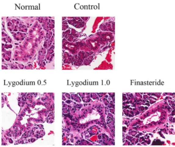 Fig. 1. Morphological profiles of the prostate tissues from the rats with benign prostate hypertrophy experimentally induced by castration and testosterone injection.