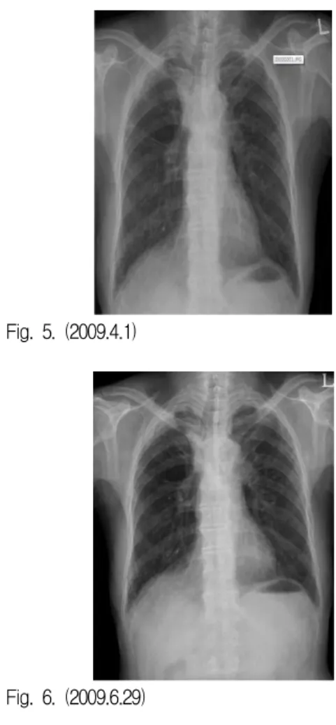Fig. 2. (2008.8.18) Fig. 3. (2008.11.5) Fig. 4. (2009.2.18) Fig. 5. (2009.4.1) Fig. 6