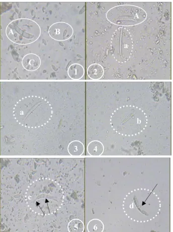 Fig. 4. Distribution of typical healthy macro-conidia (①A, ②A)  with  sickle  shape  and  three  septa  and  micro-conidia  (①B, ①C); undeveloped abnormal macro-conidia without  intact  septum  (②a,  ③a),  thickened  cell  walls  and  a  straight  oblong  