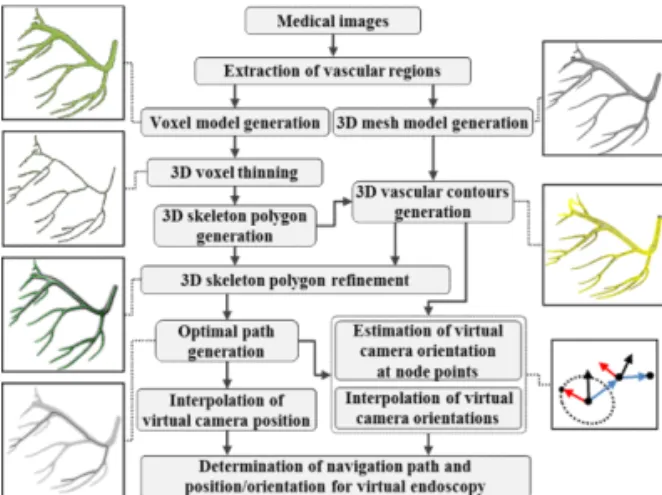 Fig. 1 Procedure for virtual navigation of blood vessels