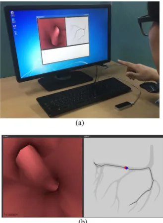 Fig. 10 Testbed environment for virtual navigation of   blood vessels using 3D curve-skeletons: (a)   Testbed environment combined with the use of   leap motion; (b) Application example of virtual   navigation of blood vessels