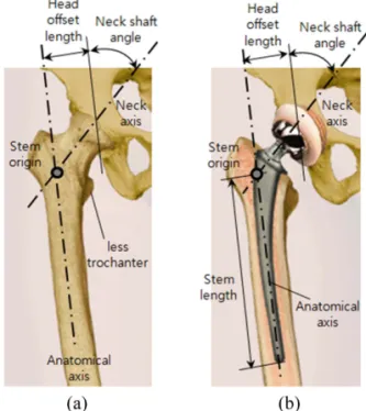 Fig. 2 Design parameters of the femur and implant [2] 