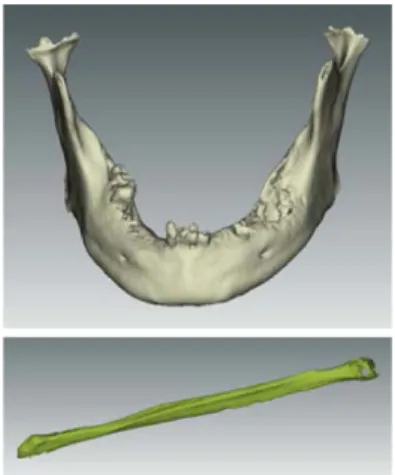 Fig. 2 Segmented 3D bone meshes. Mandible(top) and   fibula(bottom)