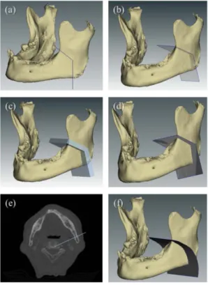 Fig. 4 Creation of cutting plane. (a) Cutting line, (b)   Cutting plane, (c) Cutting plane with thickness,   (d) Projected CT slice image on cutting plane, (e)   Location of cutting plane (b) on CT  slice image,   and (f) Curved cutting plane  