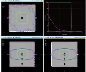 Fig. 13. (Color online) 15 mm Rectangular target dose distribution, Dynamic conformal arc calculation.
