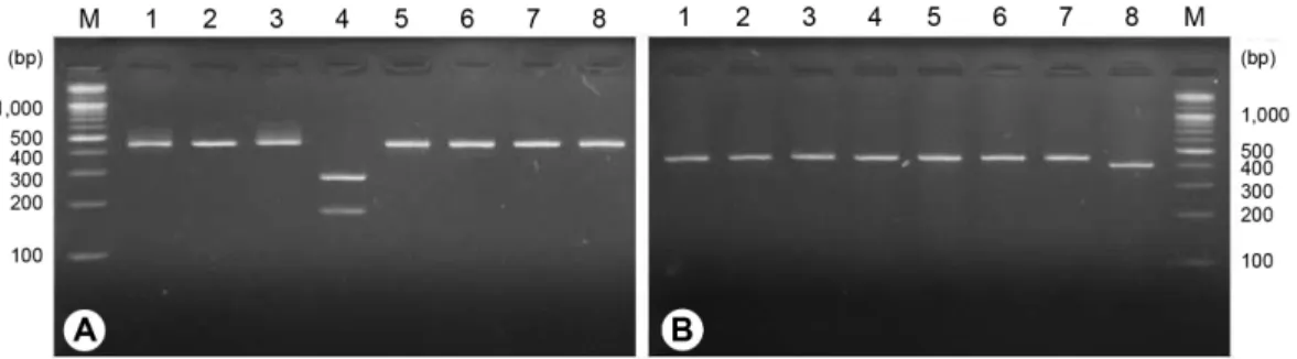 Table 2. Restriction fragment length polymorphism of 2 cyst forming nematodes based on difference of mtDNA COI gene sequences