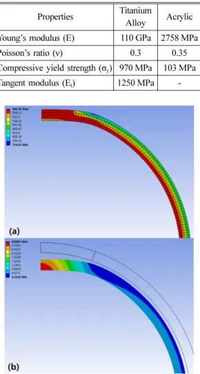 Fig. 3 Load and boundary conditions for imperfect sphere 