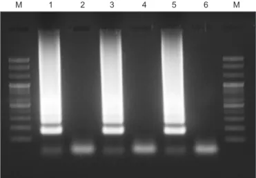 Fig. 5. Sensitivity comparison of reverse transcription-loop medi- medi-ated isothermal amplification (RT-LAMP) and RT-PCR for  detect-ing Soybean yellow mottle mosaic virus (SYMMV)