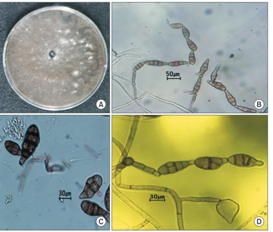 Fig. 3. Morphological characteristics of  Alter naria  mali  isolated from black  choke-berry and apple