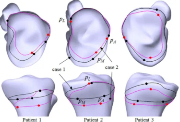 Table 2 Results of virtual OWHTO simulation using the proposed surgical planning system