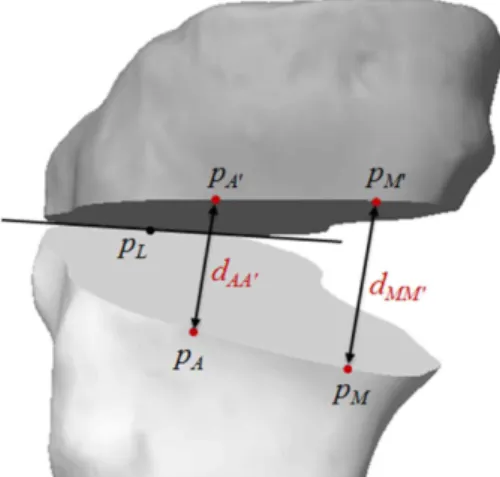 Fig. 6 Three tibial models with different slop angles and offset distances for OWHTO simulation 