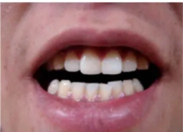 Fig. 2 Dental image captured from a subject's frontal view