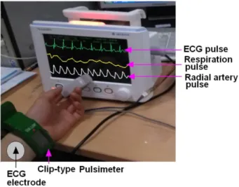 Fig. 4. (Color online) A feature of human heart and typical recorded ECG waveforms.